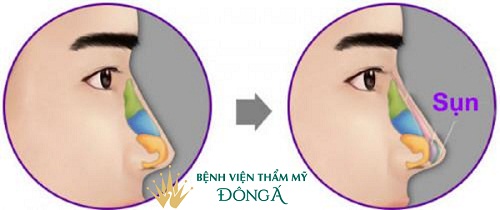 Các tướng mũi phú quý mang lại Giàu Sang và Cách để sở hữu nó - Hình 5