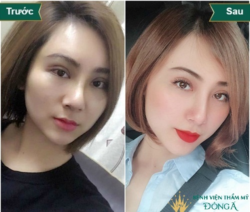 Các tướng mũi phú quý mang lại Giàu Sang và Cách để sở hữu nó - Hình 3