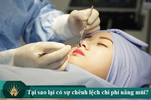 Nâng mũi cấu trúc giá bao nhiêu tiền? 3 Cách săn Sale gói sửa mũi đẹp - Hình 1