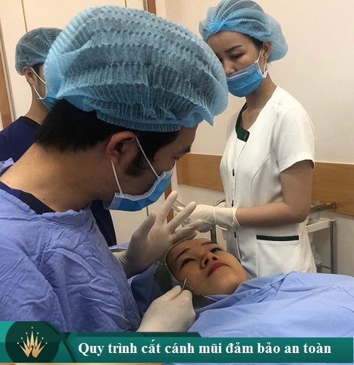 Cắt cánh mũi ở đâu đẹp ảnh hưởng bởi những điều gì? Giá cả như thế nào? 5d7f33a72383c07de793d69f_cat-canh-mui-co-hai-khong-1