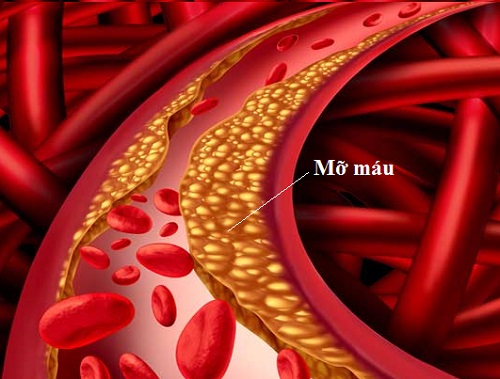 An Mạch MH có tốt không, giá bao nhiêu, mua bán ở đâu chính hãng?