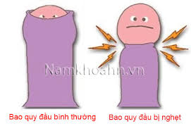 Nghẹt Bao Quy đầu Va Cach Chữa Hiệu Quả An Toan Khong Biến Chứng