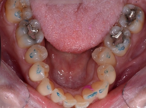 before and after treatment