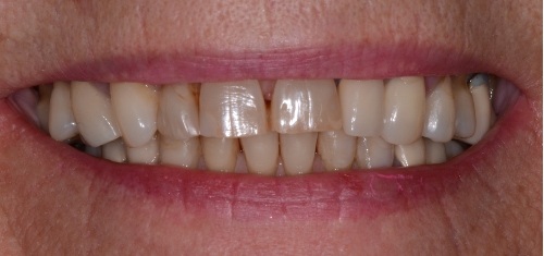 before and after treatment