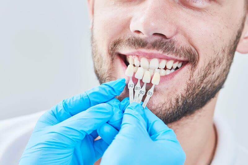 closeup of patient being fitted for veneers