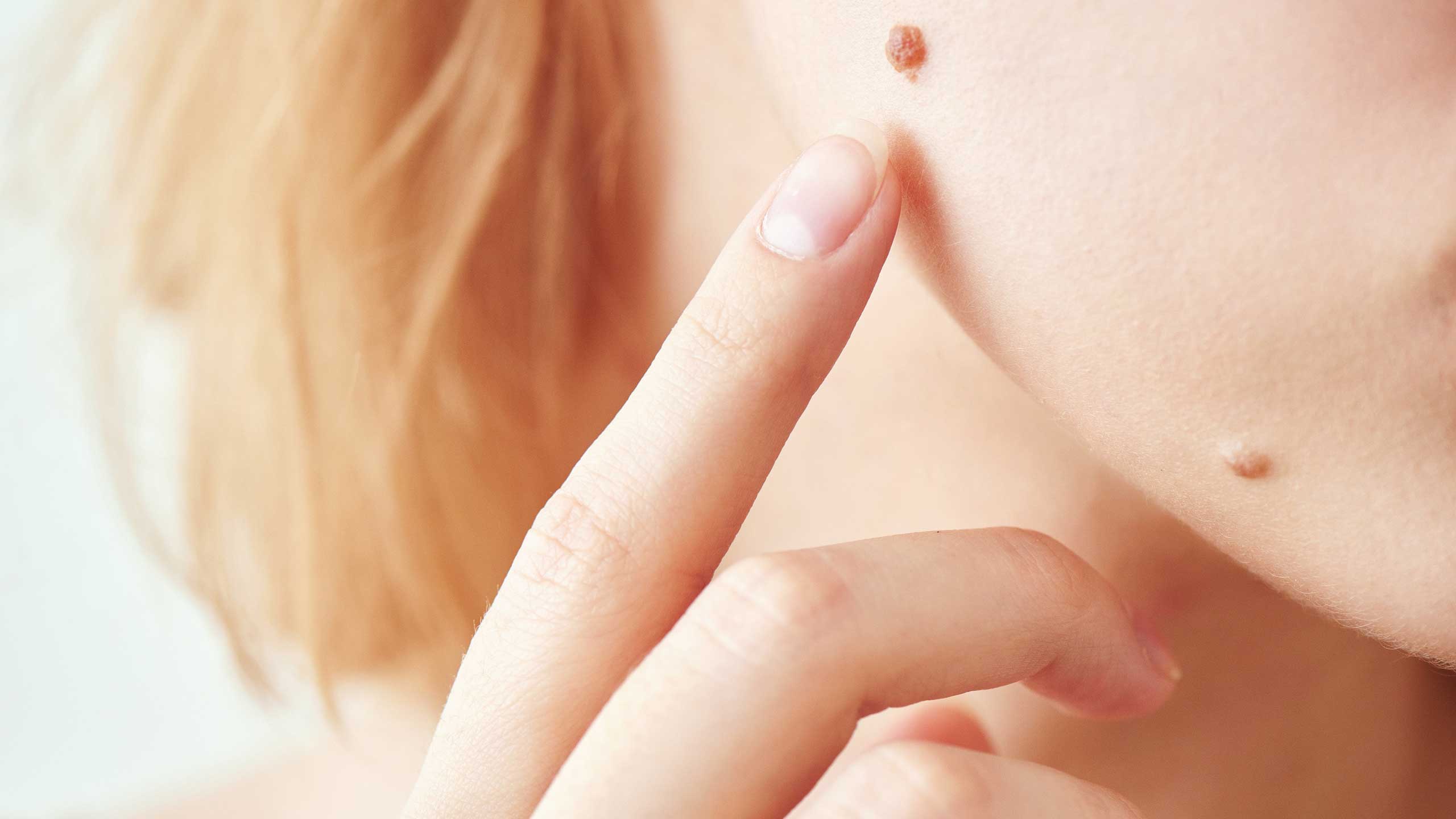 Moles