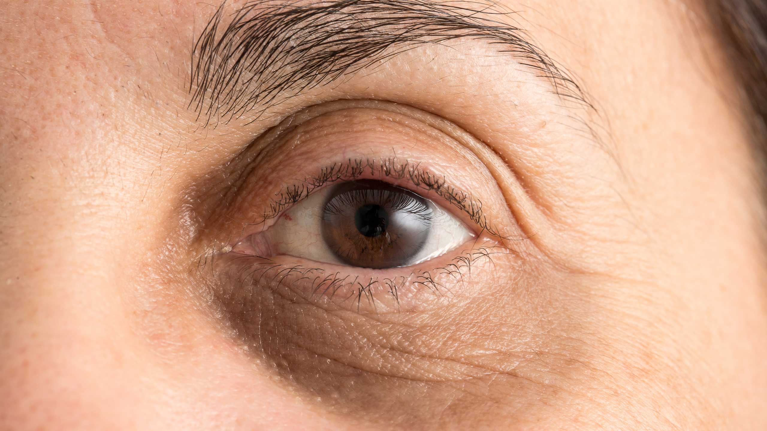 Dark Circles