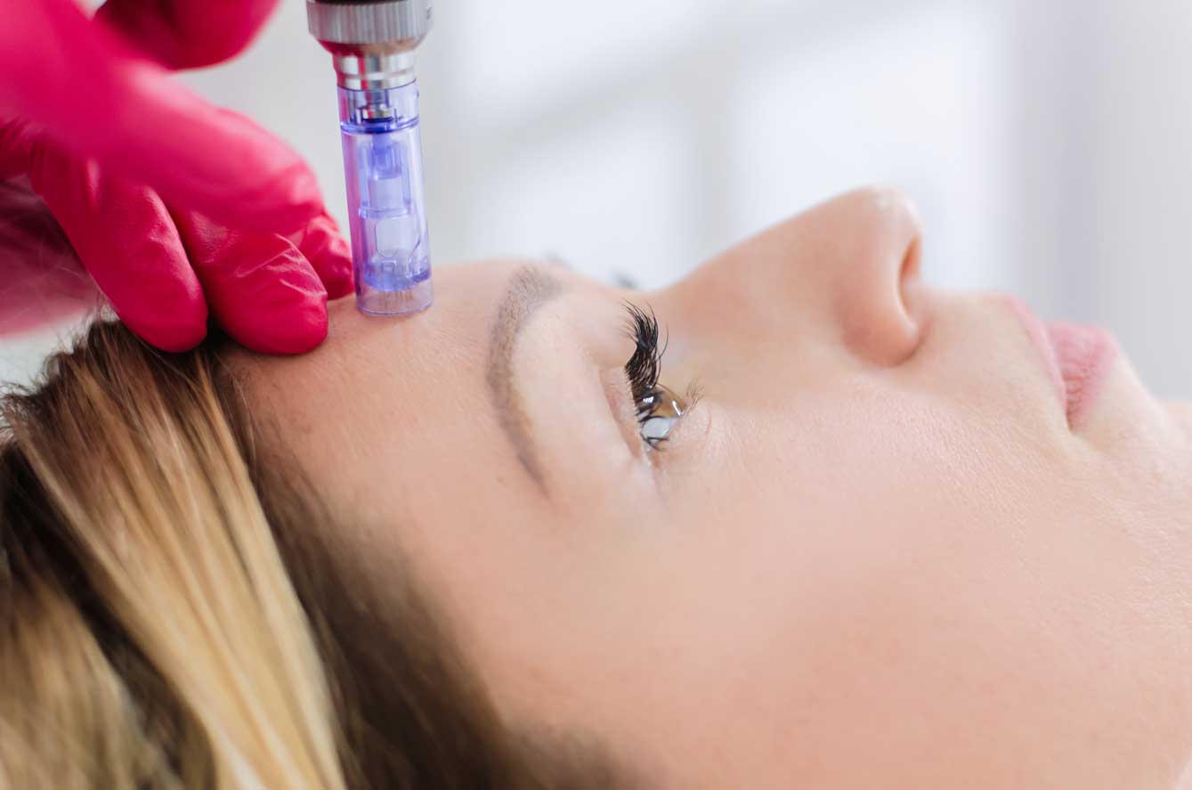 Minimise scars, pores and stretch marks with Derma FNS