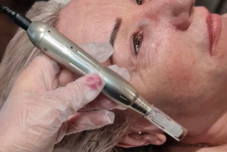 HIFU & Medical Derma FNS Needling
