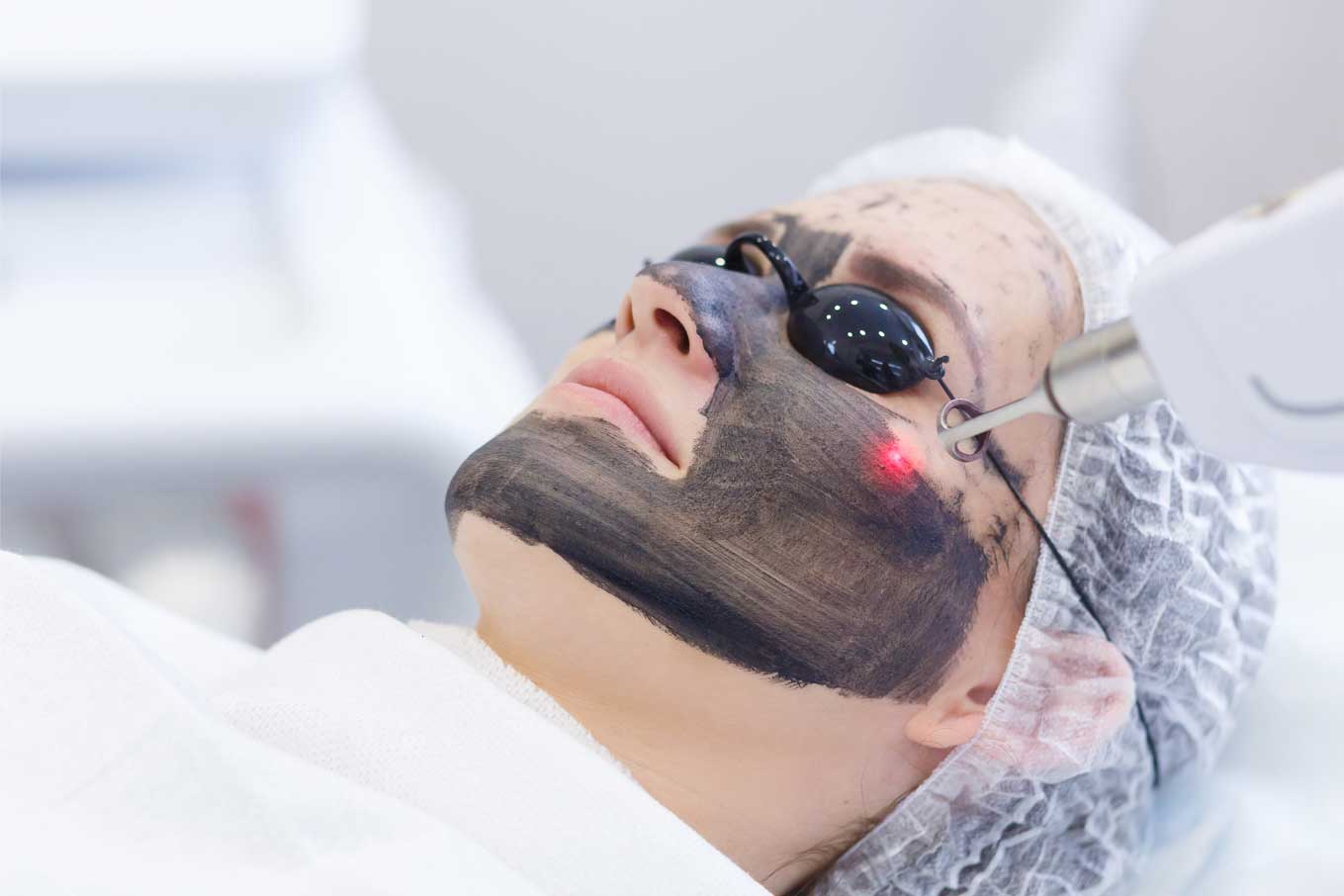 IPL & Laser Skin Rejuvenation Problem Targeting Facial