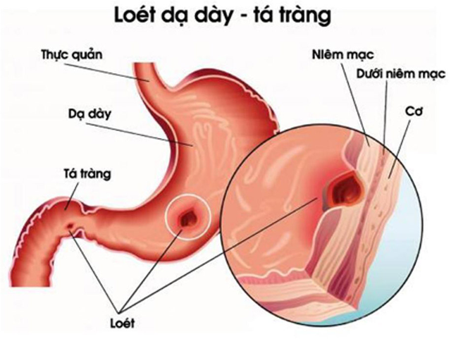 HERBAL STOMAXCARE có tốt không, mua ở đâu, giá bao nhiêu một hộp?