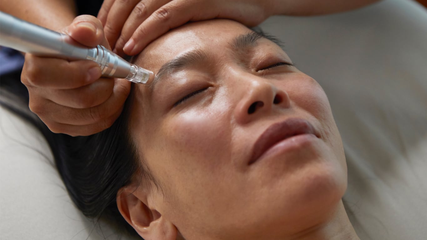 Microneedling NYC Olo Acupuncture