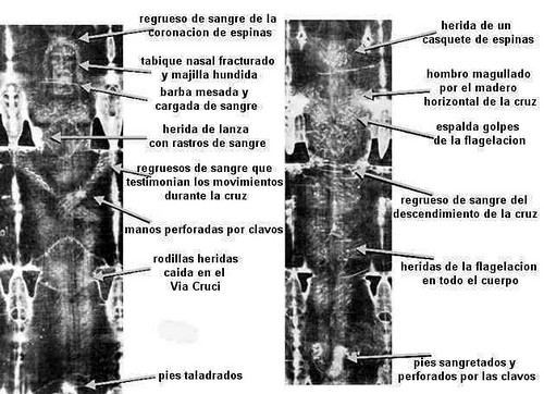 heridas del cuerpo de sabana santa
