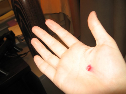 stigmata