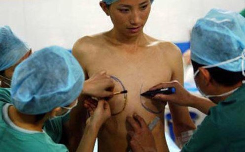 cirugia-de-cambio-de-sexo