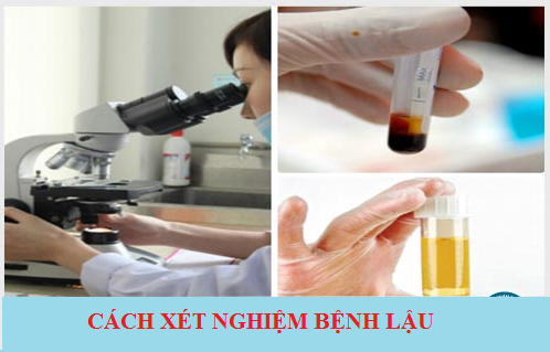 xét nghiệm bệnh lậu ở đâu