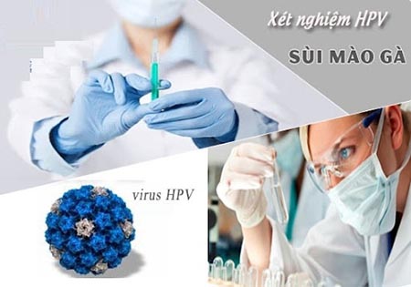 xét nghiệm hpv ở đâu