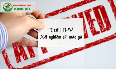 xét nghiệm bệnh sùi mào gà ở đâu