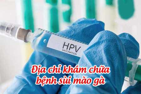 Phòng khám chữa sùi mào gà