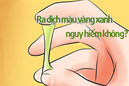 ra dịch có màu vàng xanh