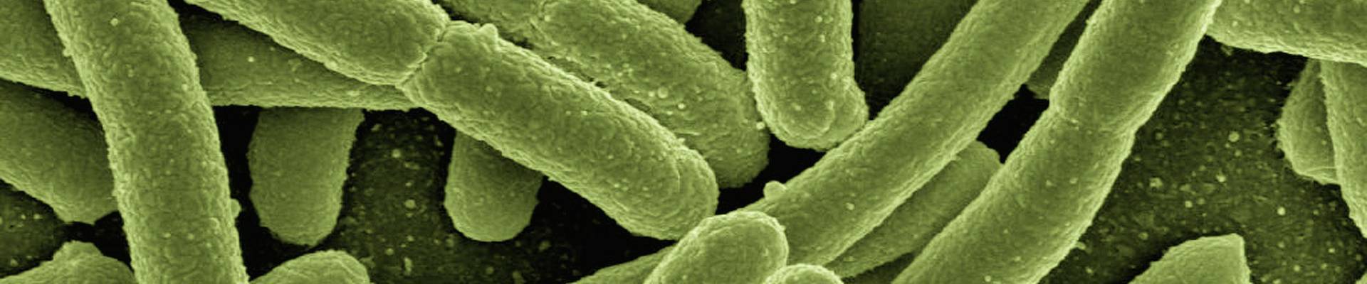 Pathogenesis of Multiple Sclerosis: Infection Model | Sort Out This MS