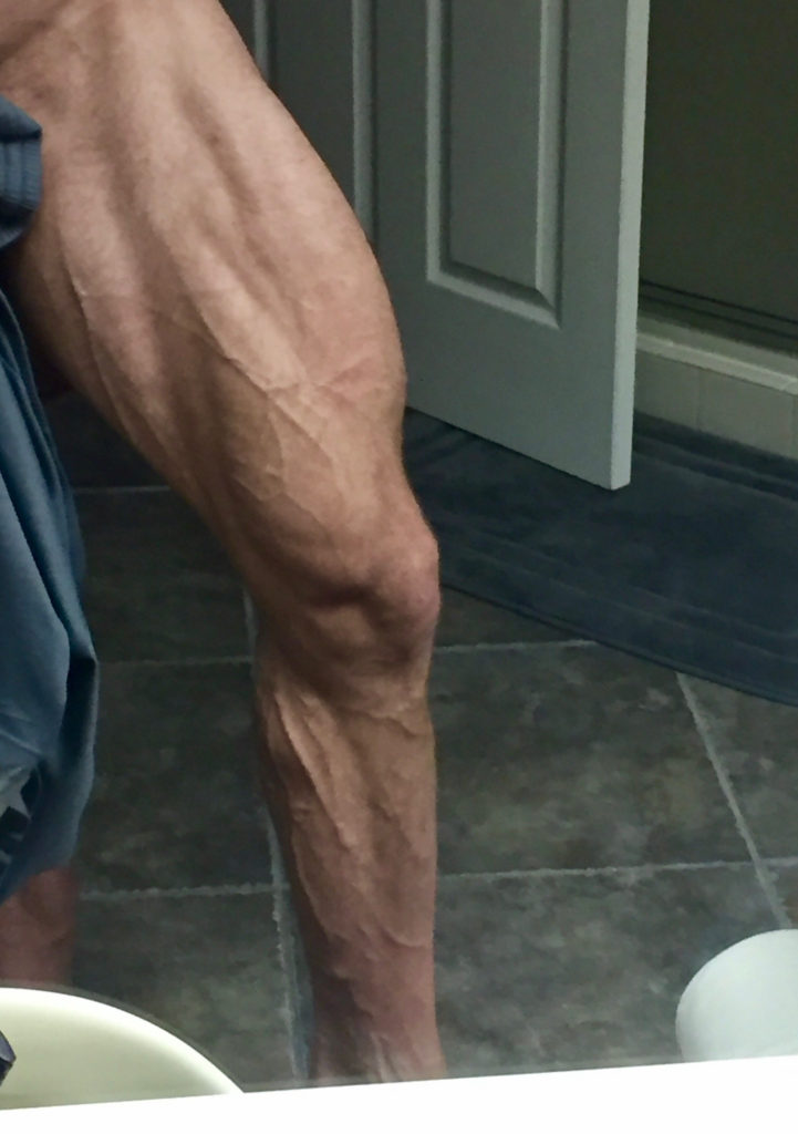 JimBrown's-Striated-Quad