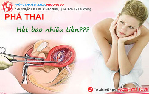 chi phí đình chỉ thai
