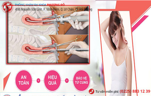 đình chỉ thai 12 tuần