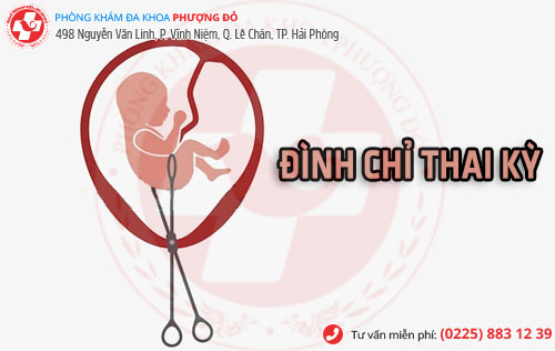 đình chỉ thai 17 tuần