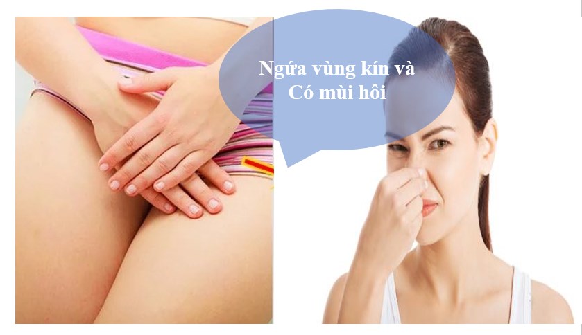 vùng kín bị ngứa rát, ra nhiều khí hư