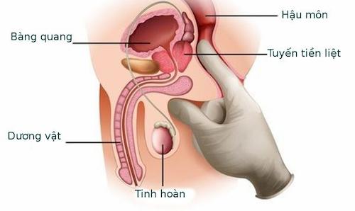 Vị trí của tiền liệt tuyến