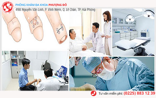 phòng khám cắt bao quy đầu