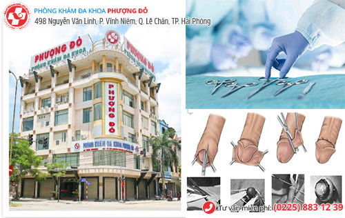 địa chỉ cắt bao quy đầu ở miền bắc