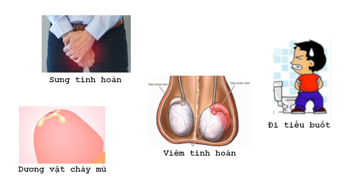 bệnh về dương vật