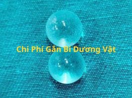 chi phí gắn bi dương vật