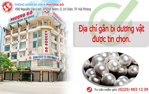 chi phí gắn bi dương vật