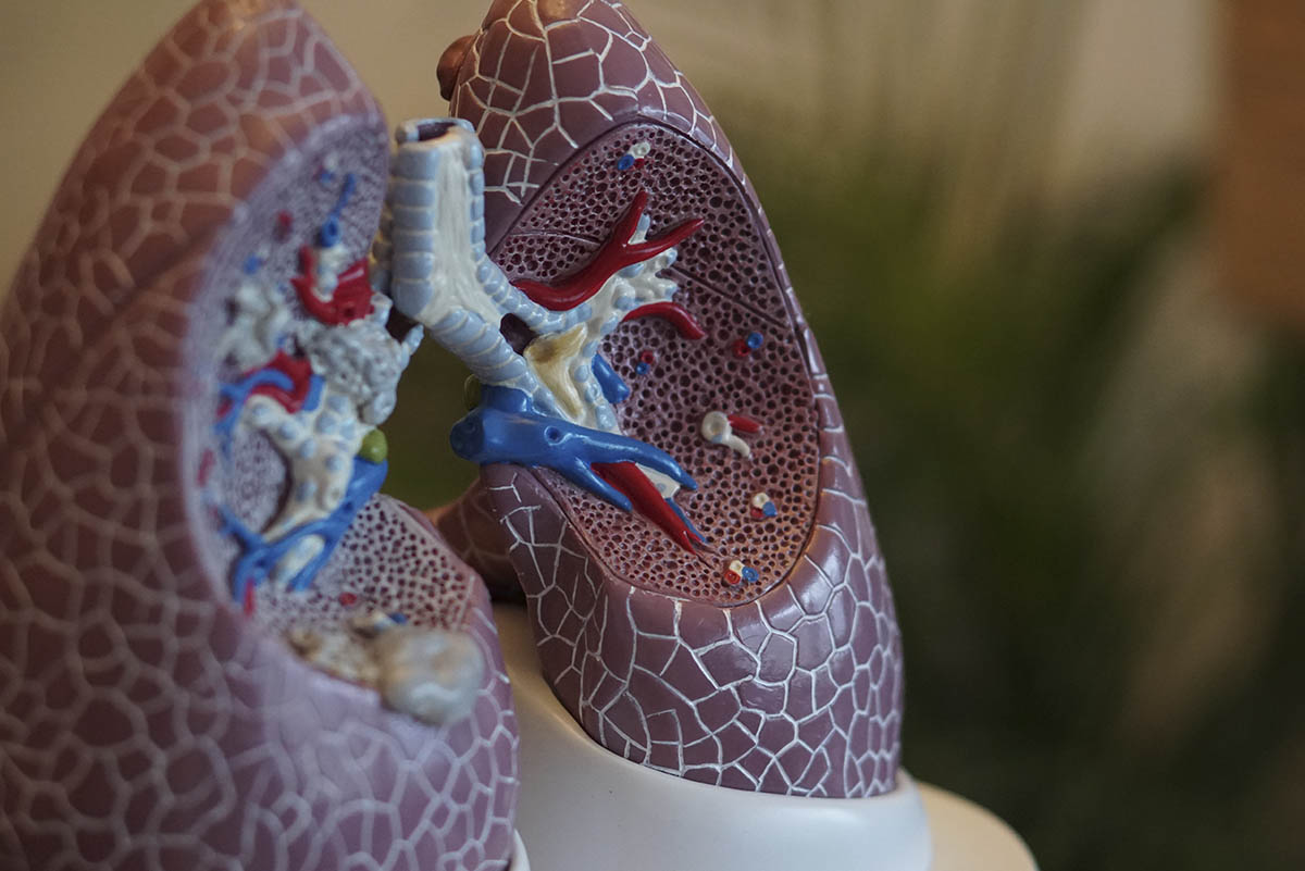 Como realmente é o pulmão de um fumante? - Instituto Marat