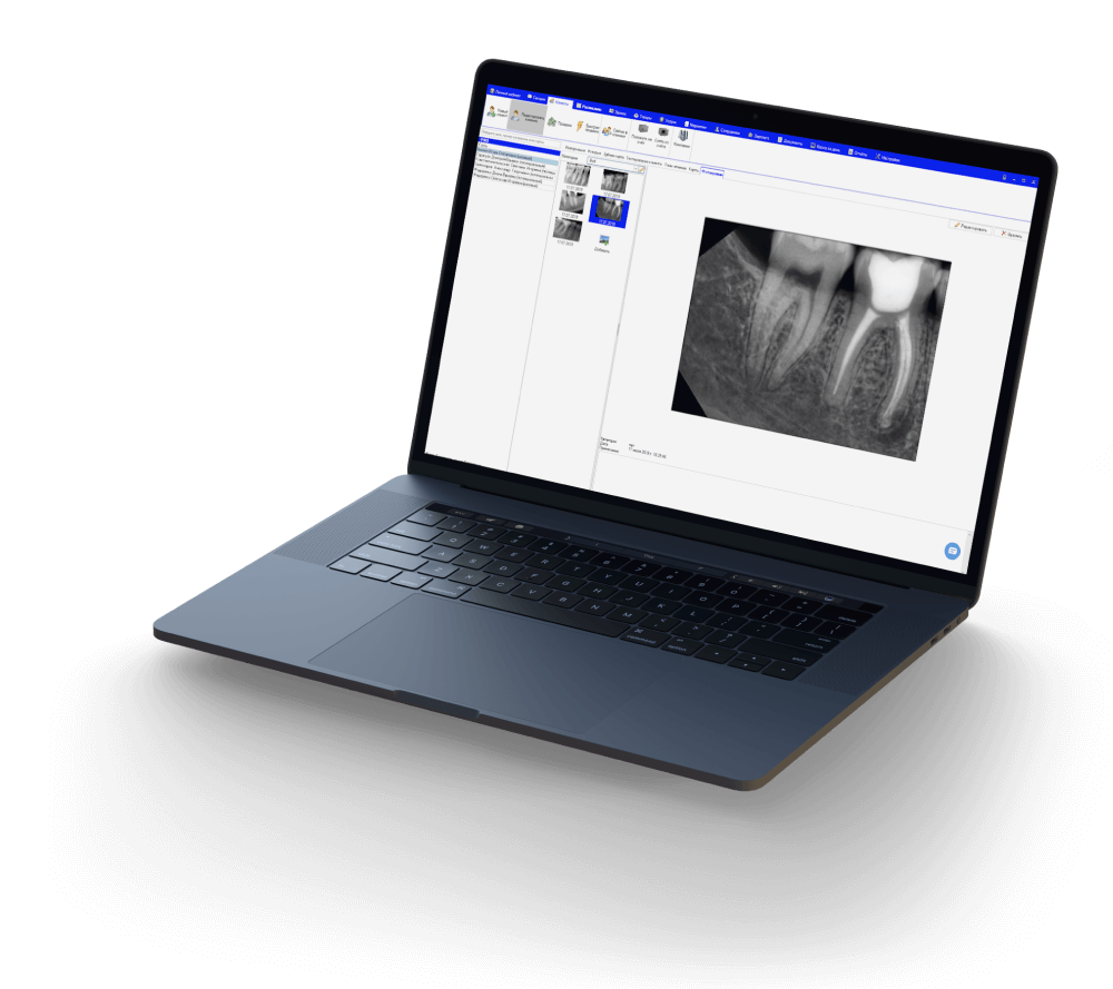 Внедрение CRM Denta Pro