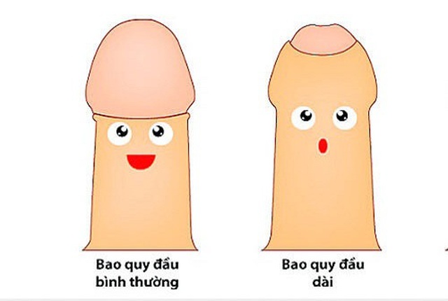 Bao quy đầu dài có nguy hiểm không? - 1