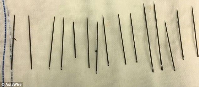 Những chiếc kim dài từ 5 đến 10 cm.