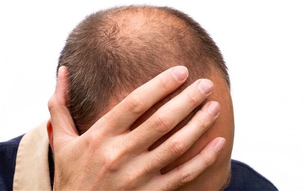 Cảnh báo: Thuốc chữa hói đầu gây rối loạn cương dương kéo dài - 1