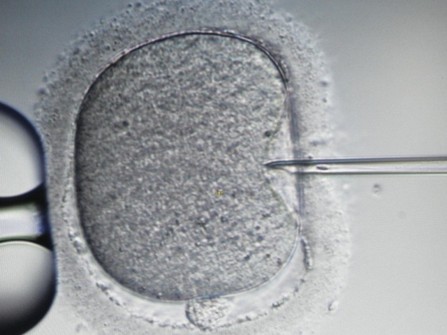 Cặp vợ chồng đã cố gắng thụ thai suốt hơn 10 năm, bào gồm 4 lần IVF thất bại.