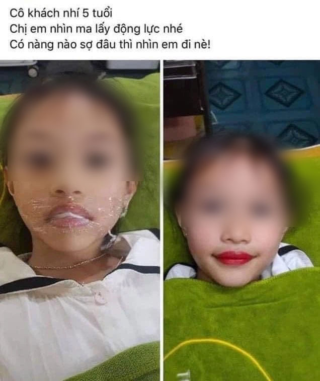Từ chuyện bé 5 tuổi phun môi collagen: Phun xăm môi cho trẻ em dẫn đến những hệ lụy gì? - 3