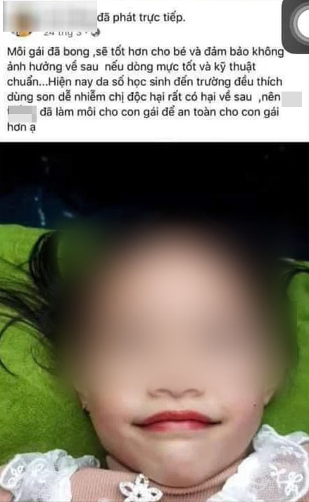 Từ chuyện bé 5 tuổi phun môi collagen: Phun xăm môi cho trẻ em dẫn đến những hệ lụy gì? - 2