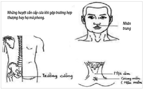 Thượng mã phong - Trạng thái nguy hiểm khi 'yêu'