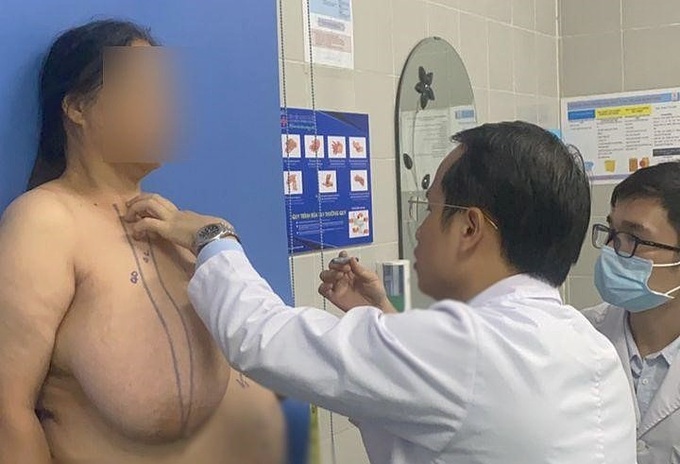 Người phụ nữ 28 năm chịu đựng bộ ngực khổng lồ