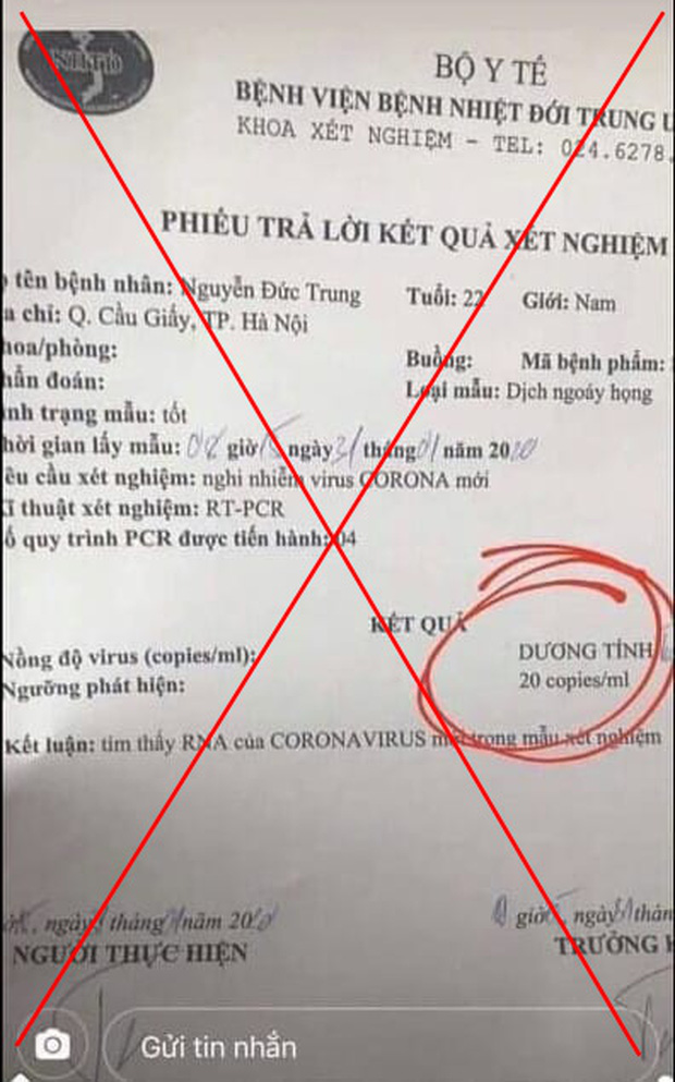 Xuất hiện kết quả xét nghiệm dương tính với nCoV giả mạo
