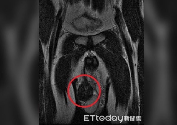 Phát hiện bạn trai có tới 3 tinh hoàn trong lúc âu yếm, cô gái ngã ngửa khi biết sự thật - 1