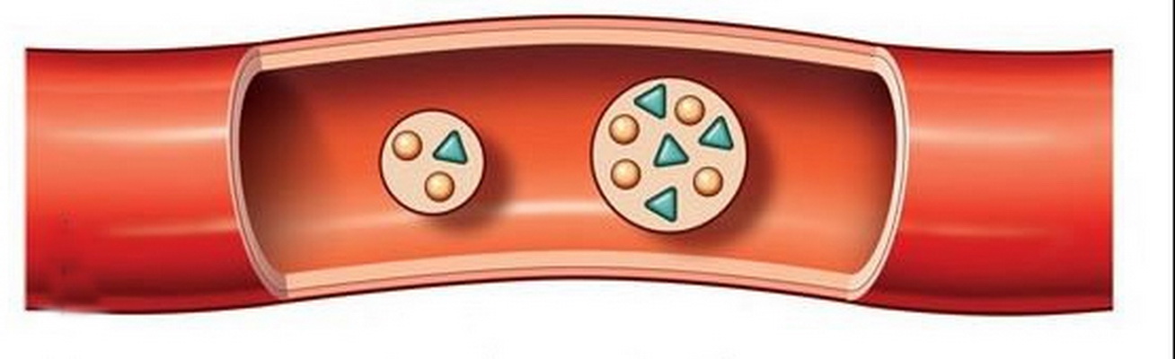 Chỉ số triglyceride tăng sẽ ảnh hưởng đến quá trình vận chuyển máu.