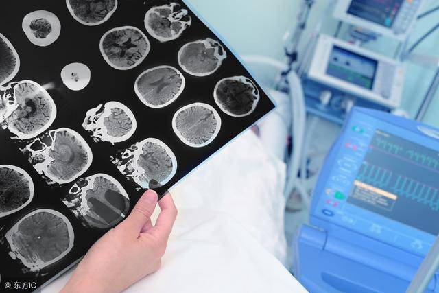 Sơ đồ cấu tạo máu bình thường, ngoài lipid máu cao thì phạm vi xung quanh là không có dấu hiệu bất thường.